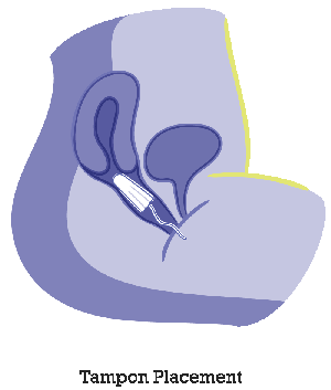 tampon-placement2